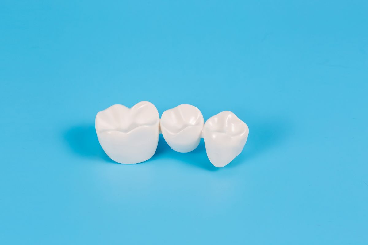 Choosing the Right Dental Crown: A Dentist's Guide