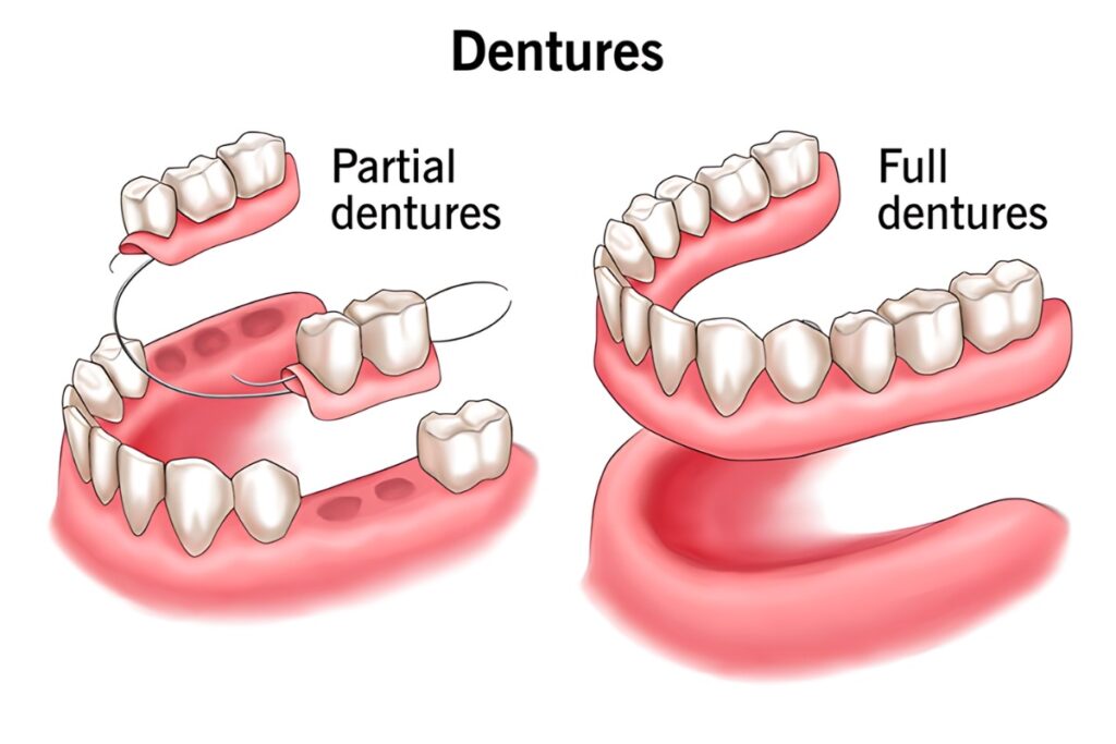 is there a difference between partial dentures and complete dentures