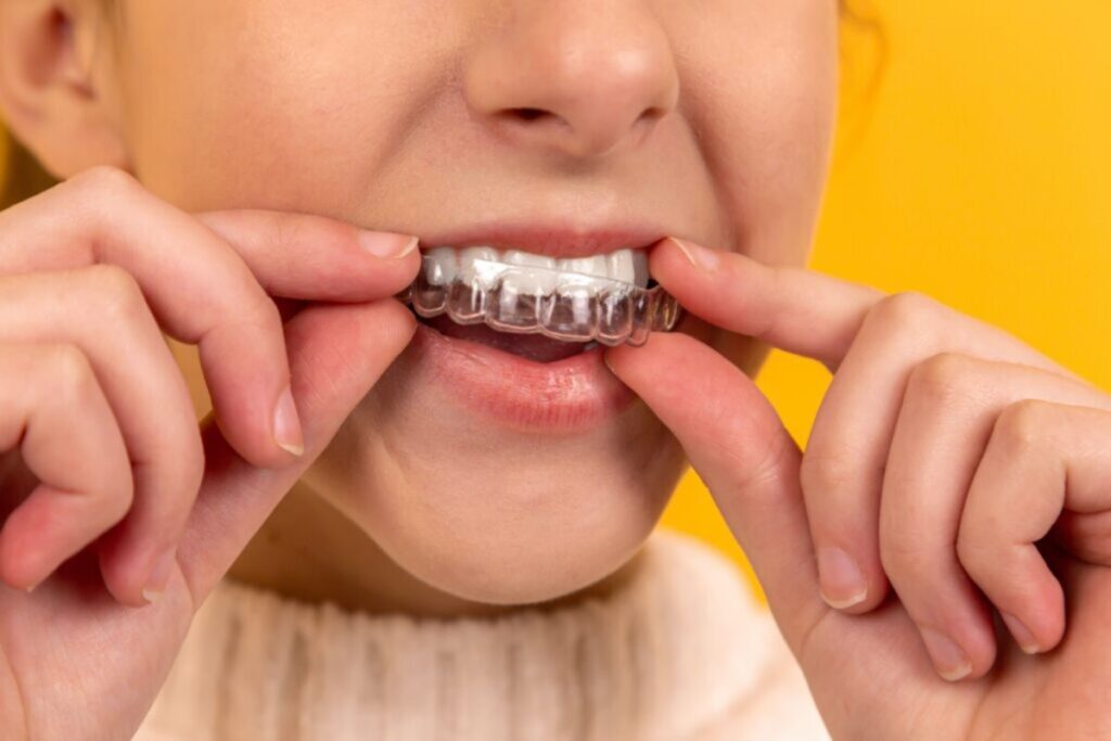 bruxism teeth grinding symptoms causes and how to treat it