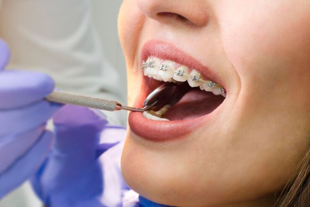 managing-discomfort-tips-for-adults-undergoing-orthodontic-treatment