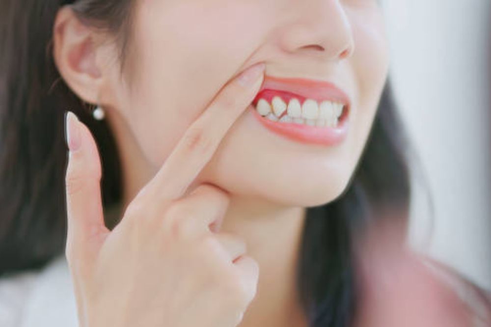 how-is-periodontal-disease-diagnosed-and-treated